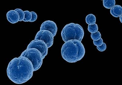 掌握如下的方法，從此蛋白表達(dá)不用愁