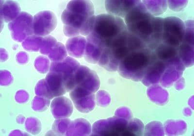 盤點(diǎn)穩(wěn)定細(xì)胞株構(gòu)建中的幾個重要步驟