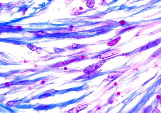 面對蛋白包涵體，我們只能束手無策？
