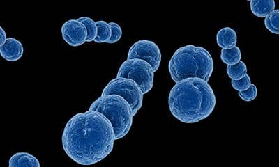 采用真核表達系統(tǒng)表達蛋白時如何做好蛋白純化?