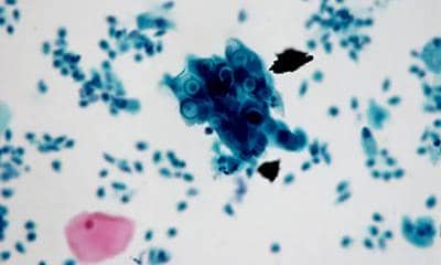 盤點多克隆抗體的優(yōu)點和缺點