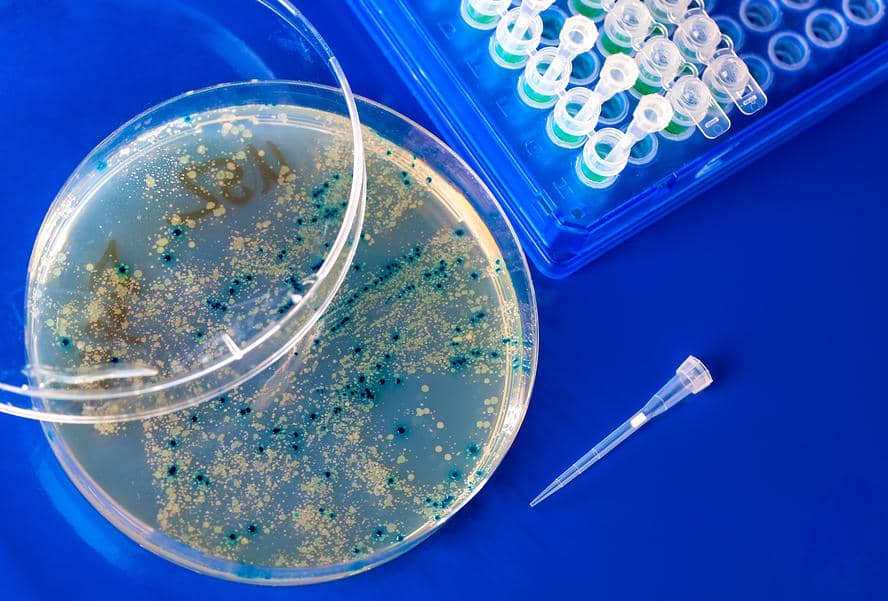 噬菌體展示文庫及噬菌體展示技術(shù)對(duì)腫瘤學(xué)的貢獻(xiàn)