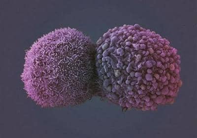 雜交瘤技術(shù)制備抗體的相關(guān)原理和詳細(xì)步驟