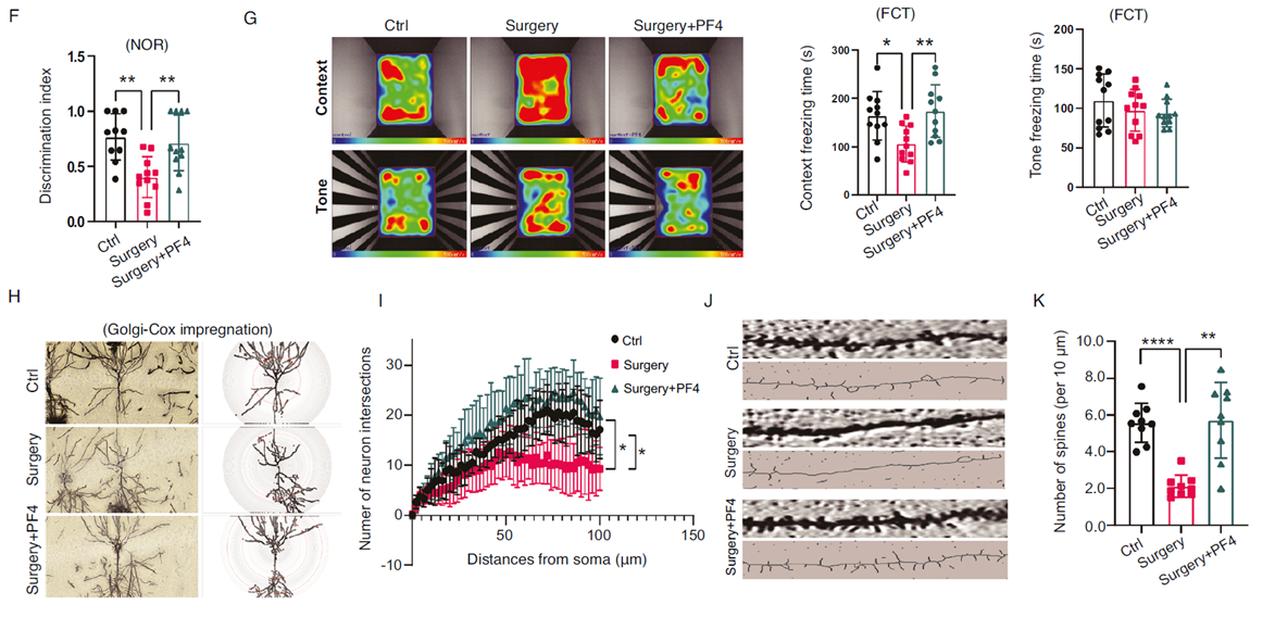 PF4可改善并修復(fù)認(rèn)知功能