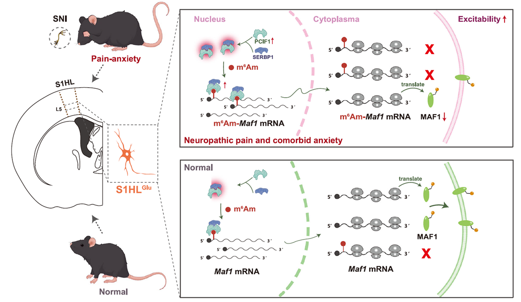 S1HLGlu神經(jīng)元中的SERBP1-PCIF1復合體如何參與神經(jīng)性疼痛和并發(fā)焦慮的發(fā)育與維持